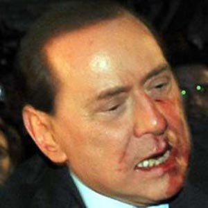 دندانهاى برلوسکونى خورد شد